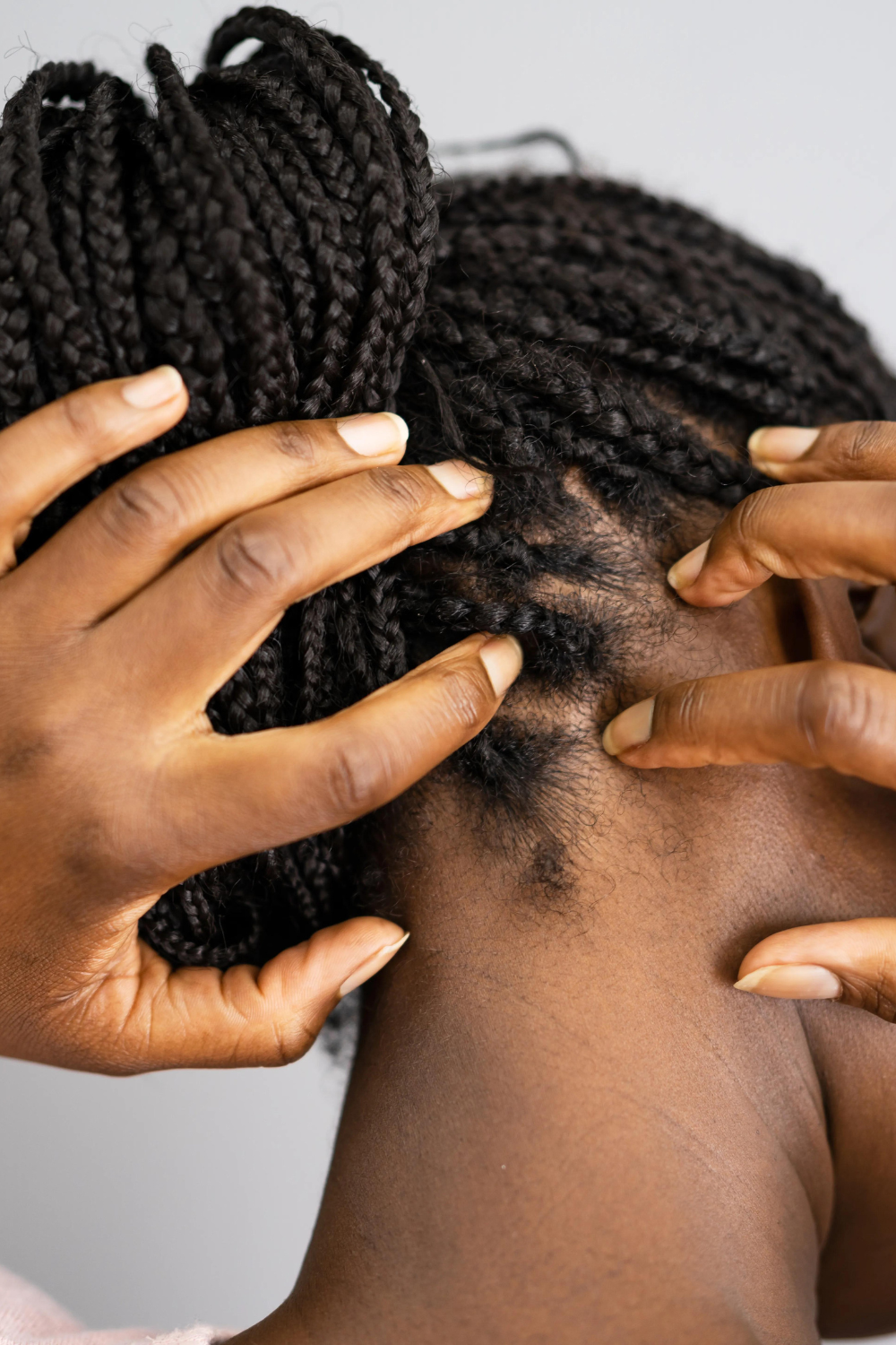 8 Reasons Your Dry Scalp Is Driving You Crazy